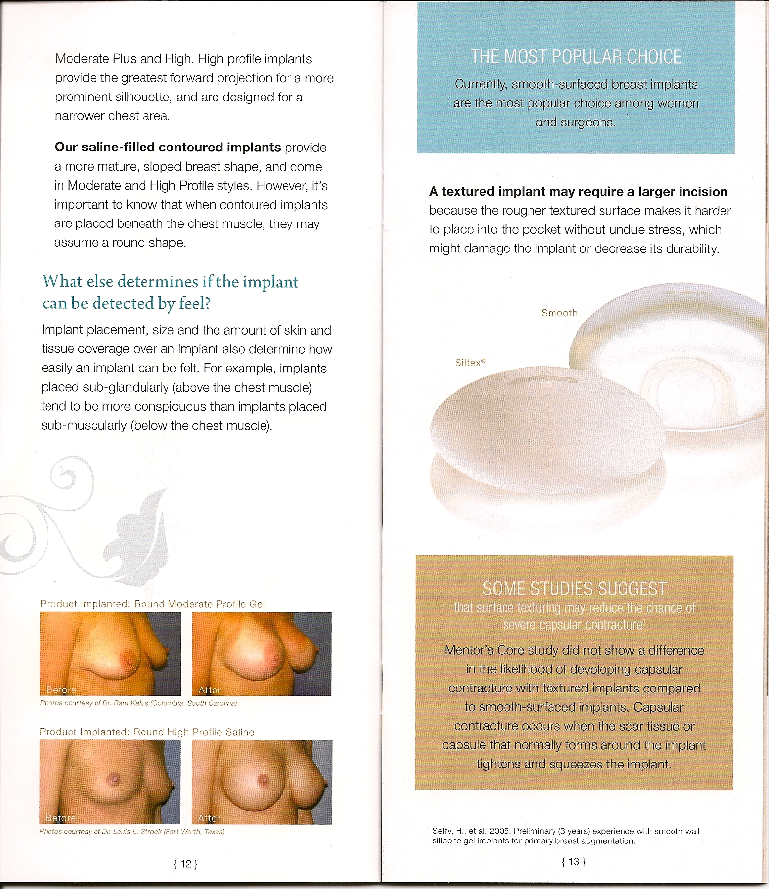 How To Read Mentor Implant Id Card